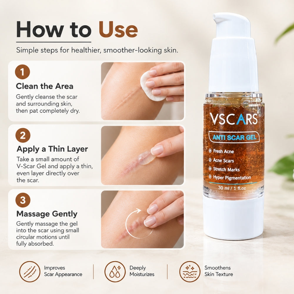 V-Scars Gel
